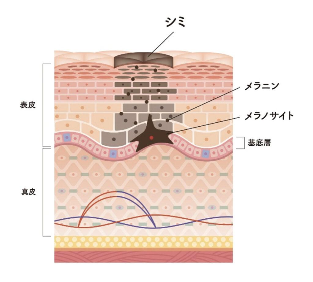 しみの治療