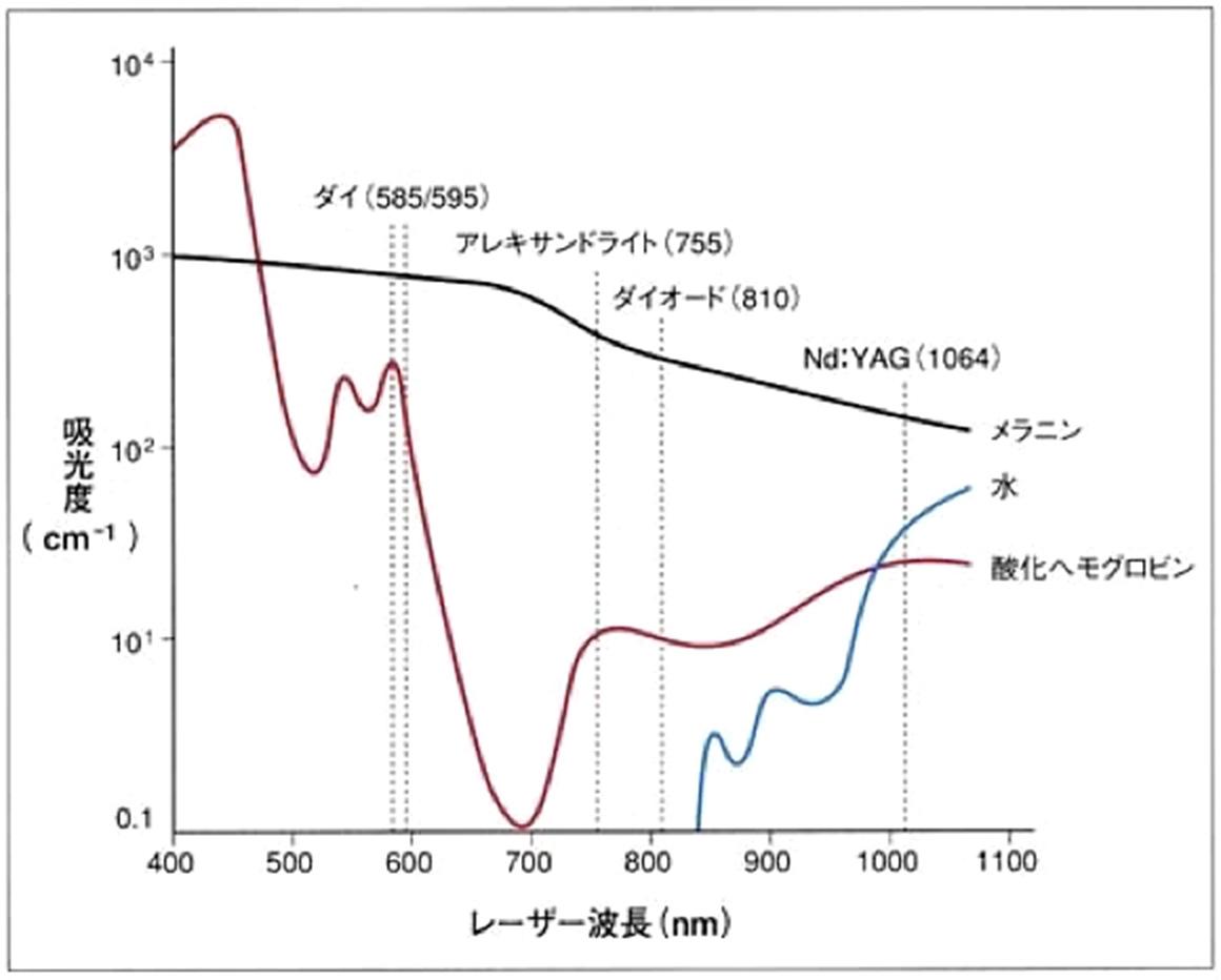 吸光度とレーザー波長